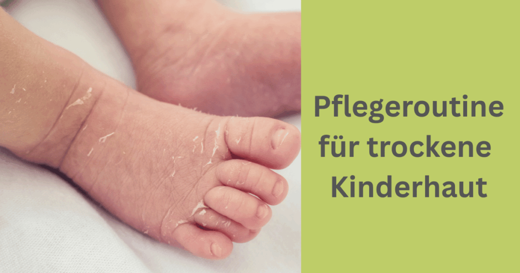 Nahaufnahme von trockener Babyhaut an den Füßen mit Text „Pflegeroutine für trockene Kinderhaut“ – Hinweis auf natürliche Hautpflege